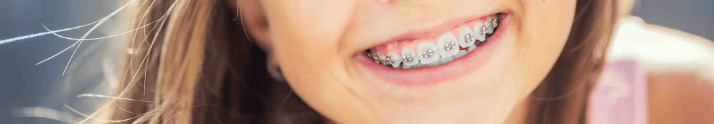 Alles over onze praktijk Orthodontie Praktijk Houten